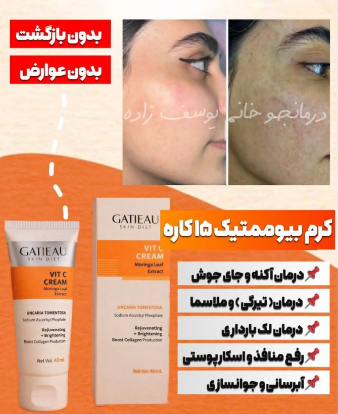 کرم بیوممتیک ضد لک جهانی جوانساز کلاژن ساز ضد جوش گاتیو 12کاره ویتامین سی