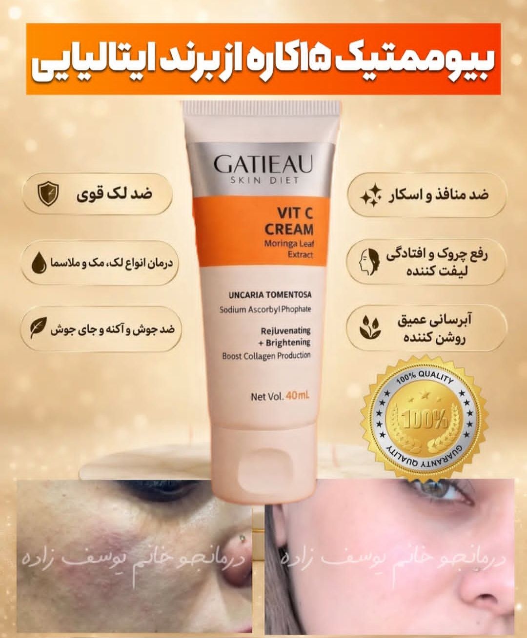 کرم بیوممتیک ضد لک جهانی جوانساز کلاژن ساز ضد جوش گاتیو 12کاره ویتامین سی