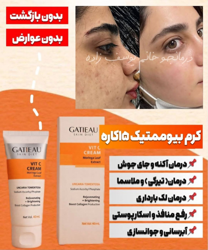 کرم بیوممتیک روشن کننده کلاژن ساز چند کاره گاتیو ایتالیا ۴۰ میل
